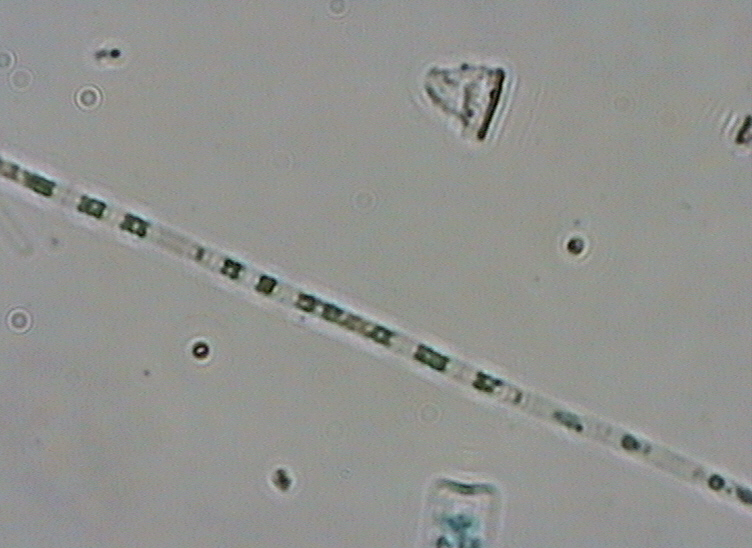 Dictyocha speculum